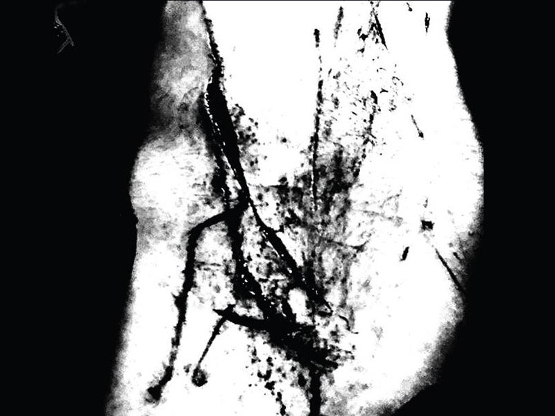 Kollaps appearing at this event