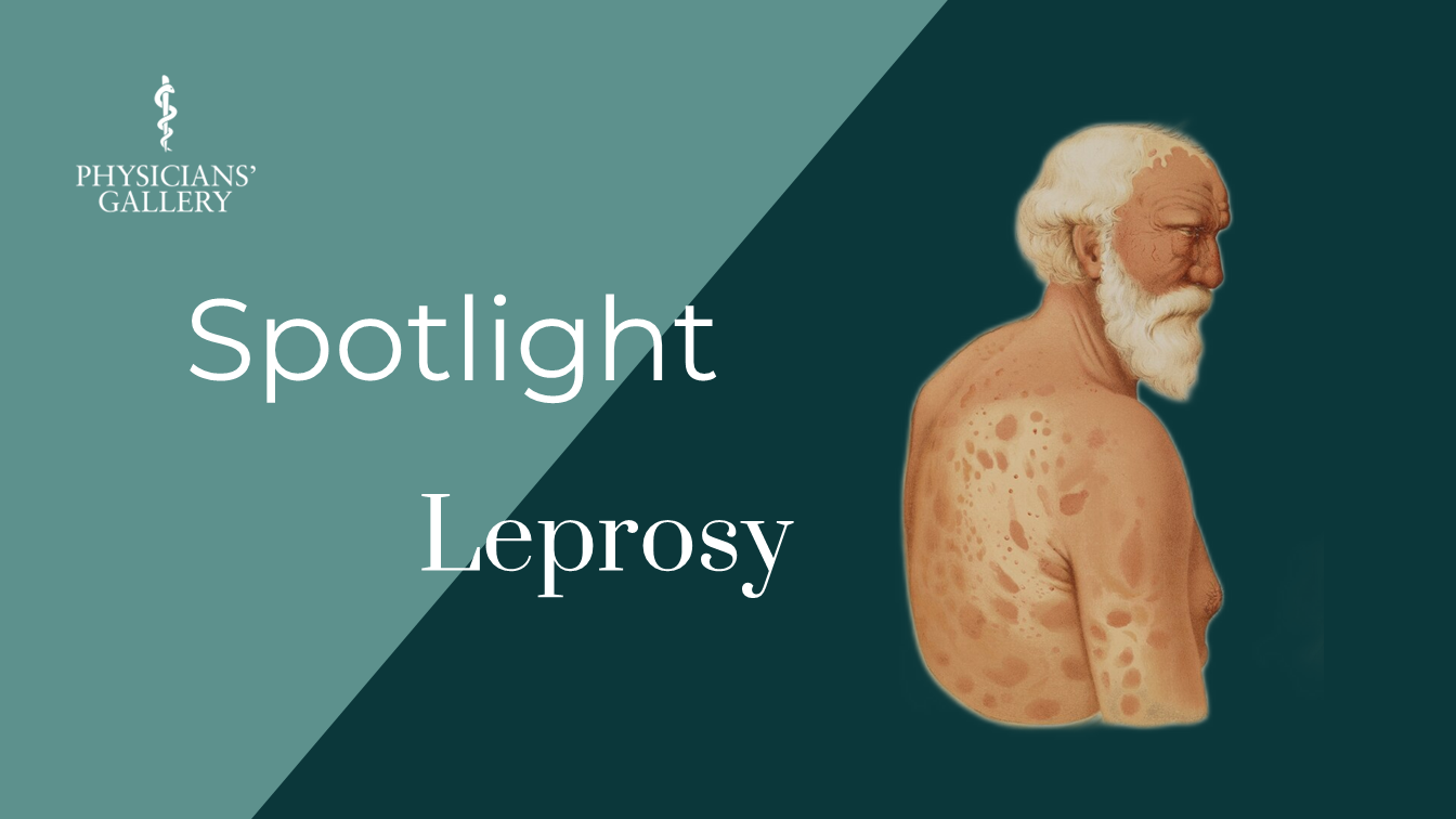 Picture of Spotlight: Leprosy