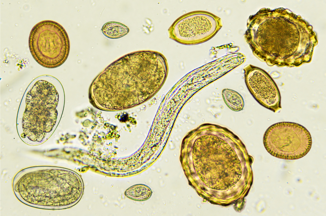 Picture of Modern Medicine: Parasites